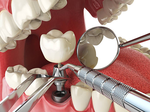 Best Emergency Treatment for Toothache in Eglin Af, FL